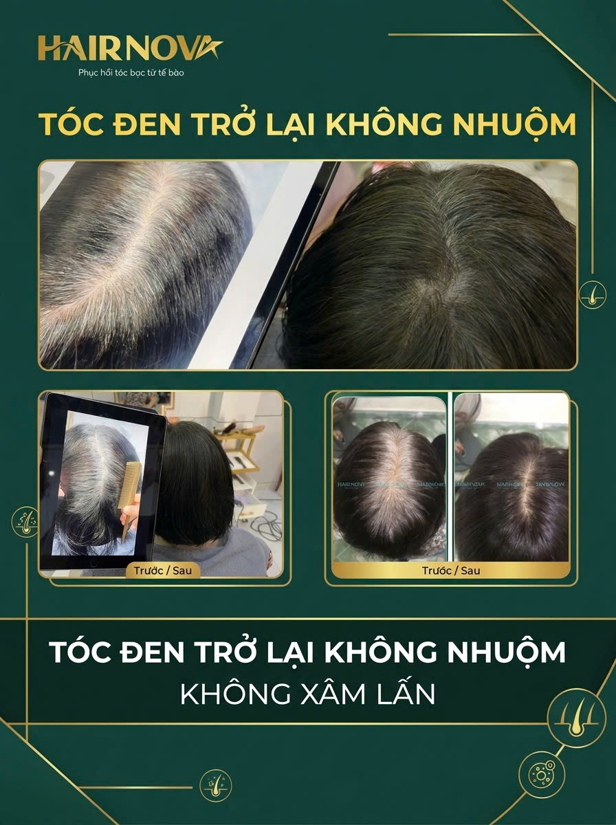 Kết quả phục hồi kích thích mọc tóc